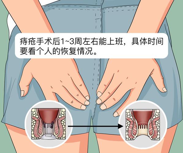 微创手术多久可以出去旅游-微创手术几天后可以上班