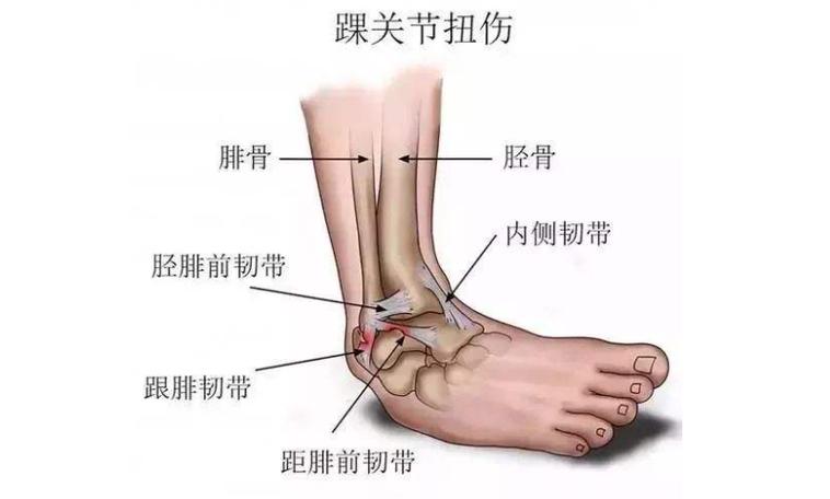 脚踝扭伤多久可以旅游-脚踝扭伤多久能健身